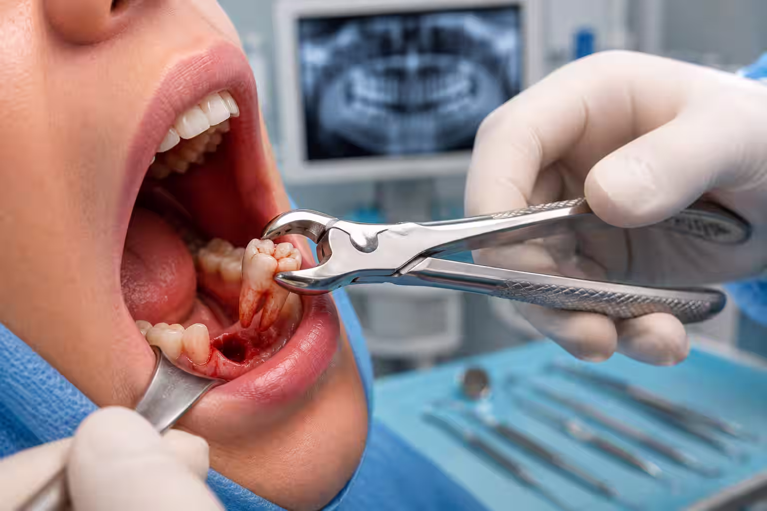 Oral Surgical Treatment